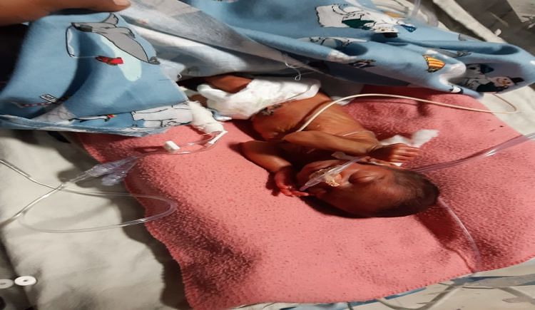 premature baby 7 months effects