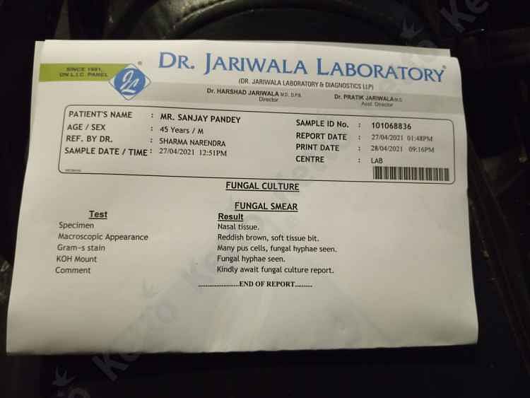 my diabetic brother is suffering from a fungal eye infection after being diagnosed with covid19 with chances of brain haemorrhage if the infection reaches his brain we need your help to provide