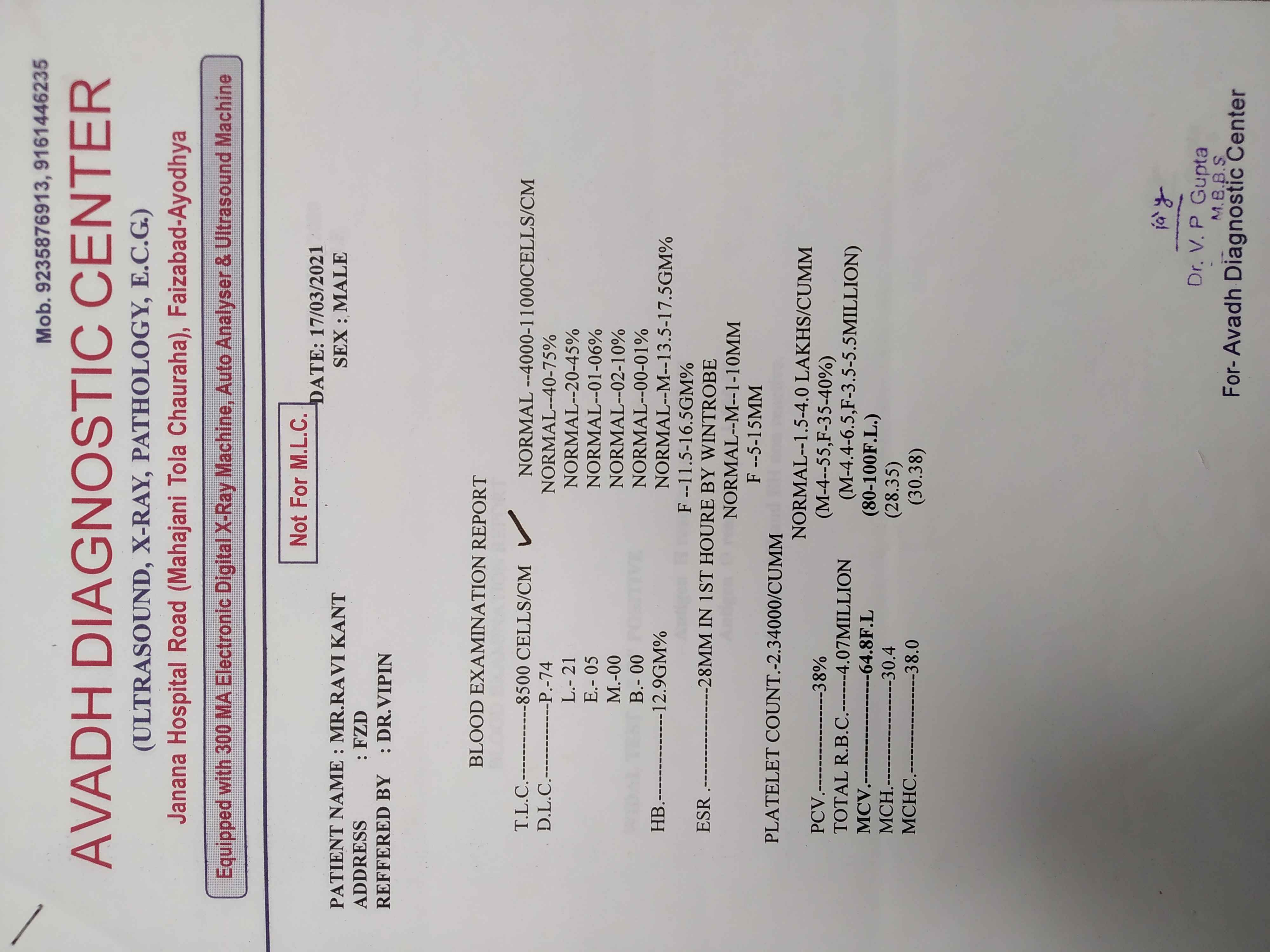 Typhoid Blood Test Report Time