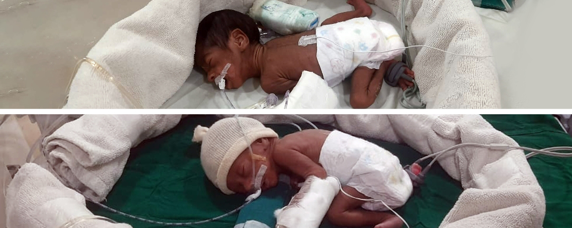 Let Us Be The Saviours Of These Premature Twins Born At Just 6 Months 