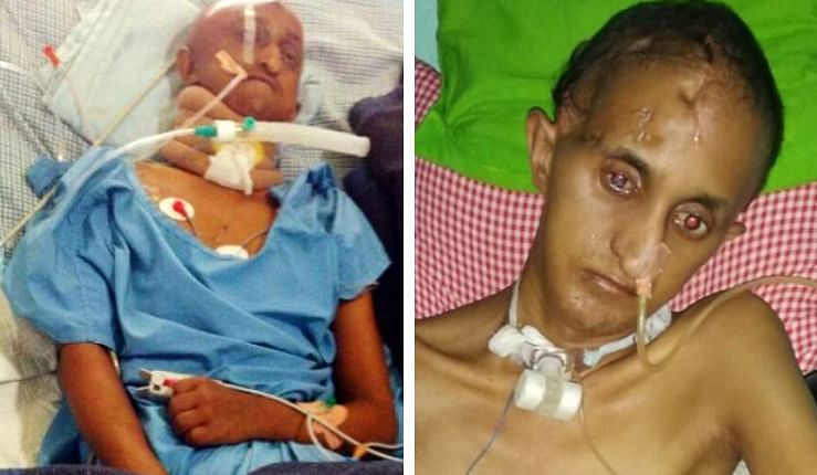Accident Victim Suffering From Severe Head Injury, Needs Help For His