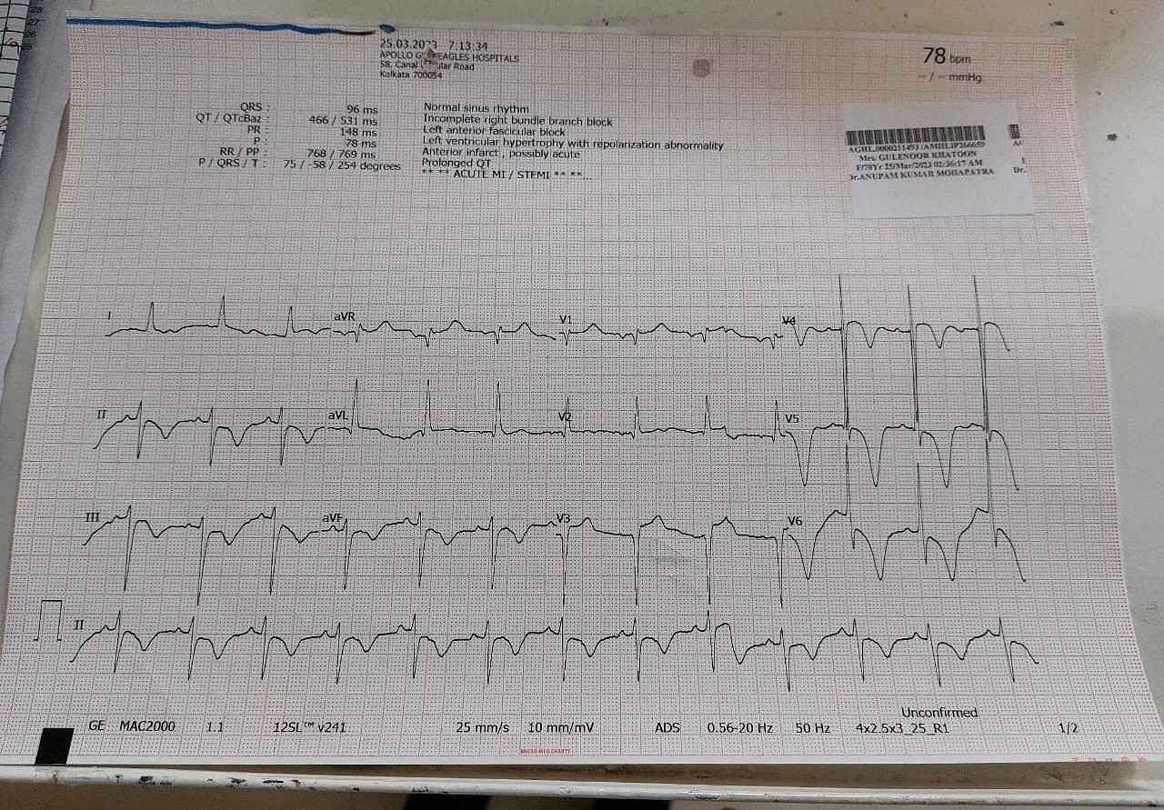 My Mother Is Suffering From Chest Infection. We Need Your Help To