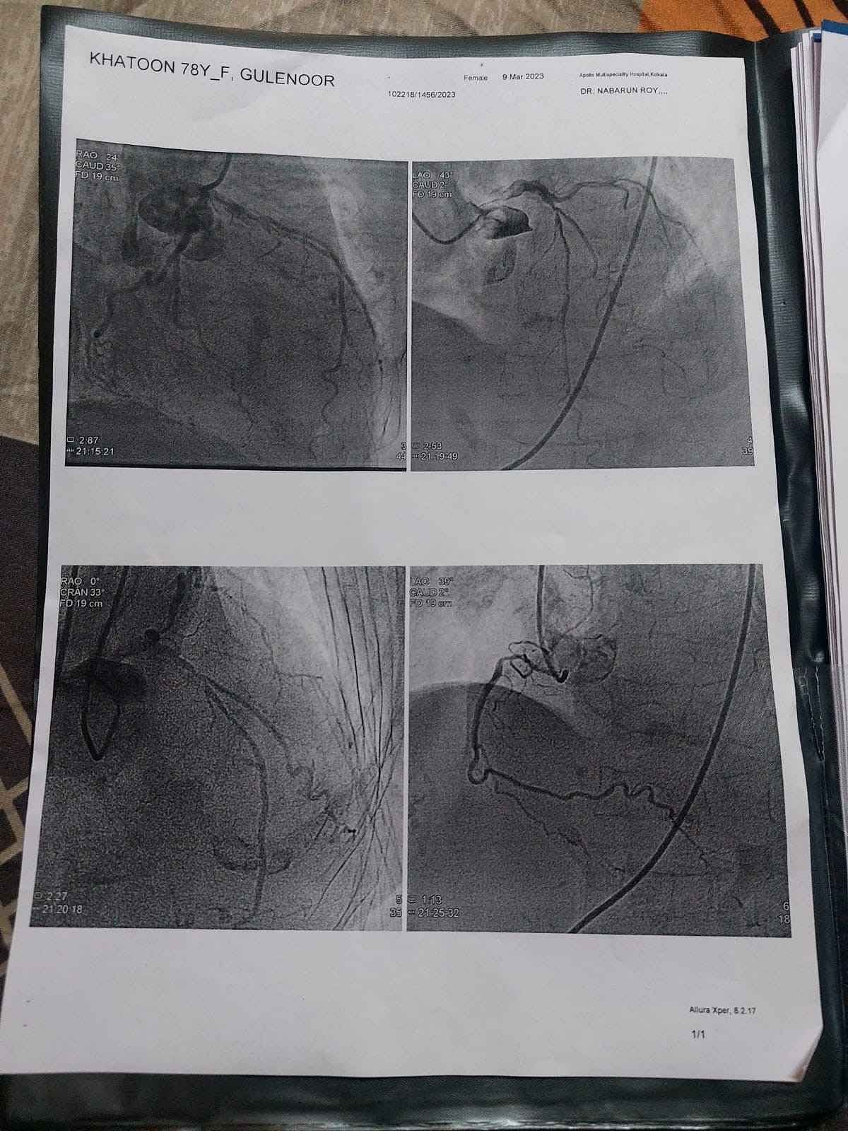 My Mother Is Suffering From Chest Infection. We Need Your Help To