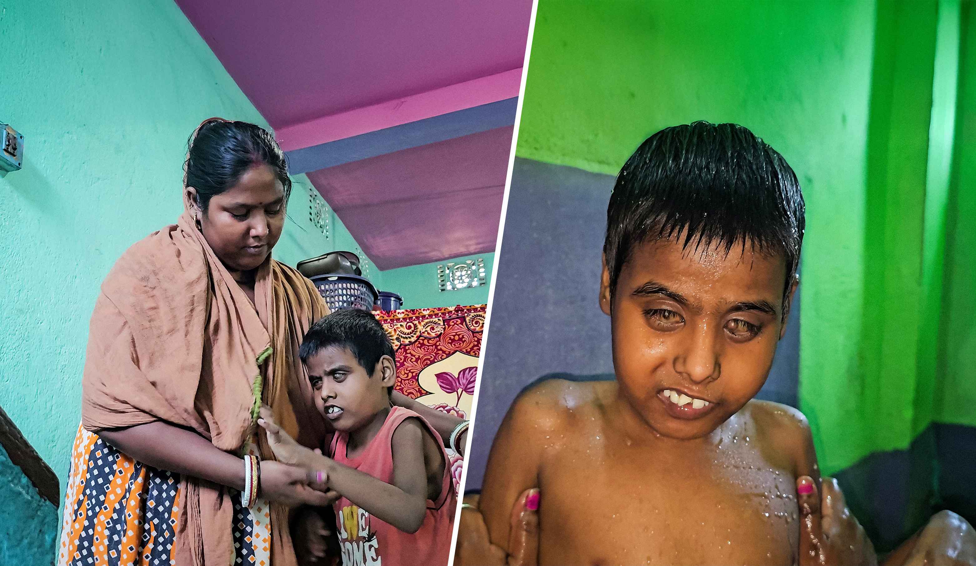 Nearly Two Decades After The Burn Incident Her Treatment Hasn t nearly-two-decades-after-the-burn-incident-her-treatment-hasn-t