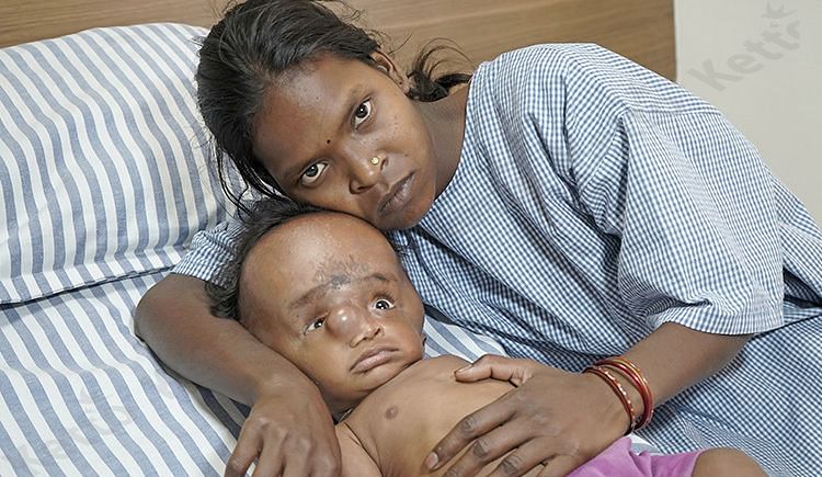 Help Us Save Jaikumar End His Pain Give Him Life Ketto